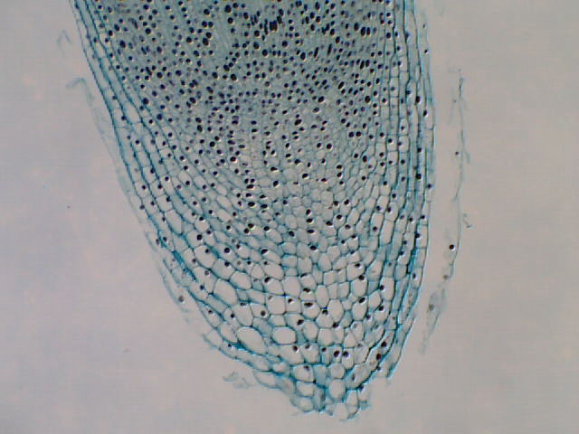 Which action would you take to increase the magnification of this image (to make the individual cells appear larger)?