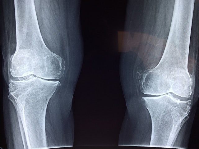 Which of these describes the properties of a bone?