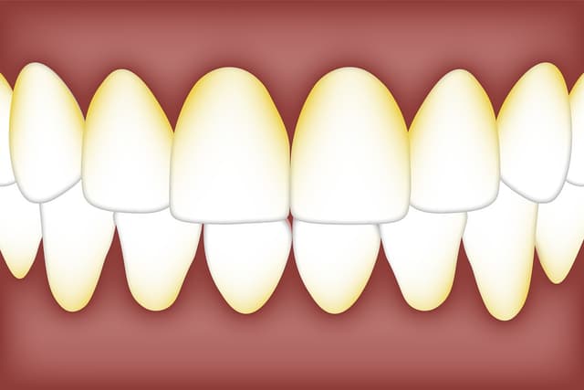 An image in a quiz